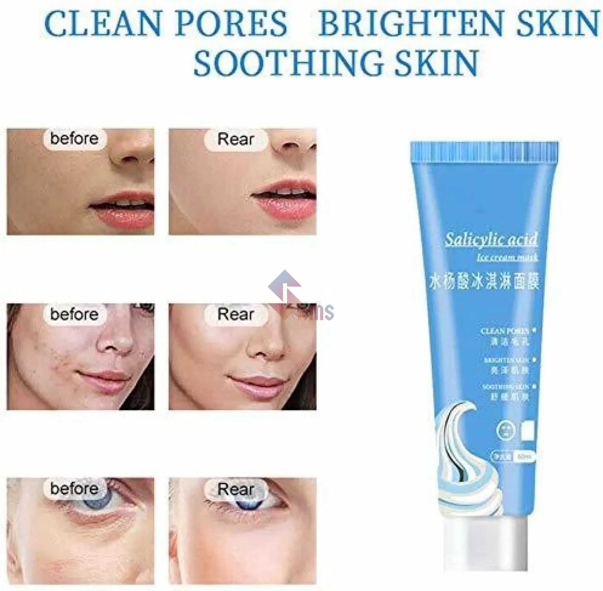 Salicyclic acid Mask4.webp